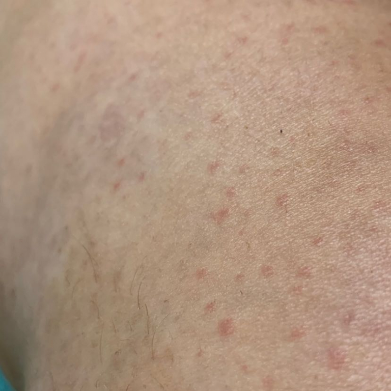 Изображение 0