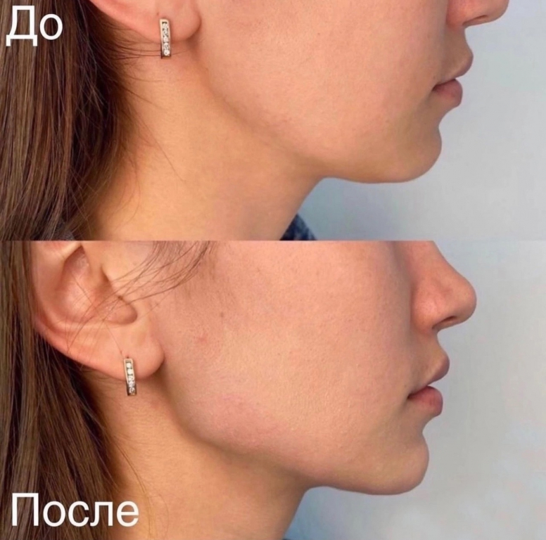 Изображение 7