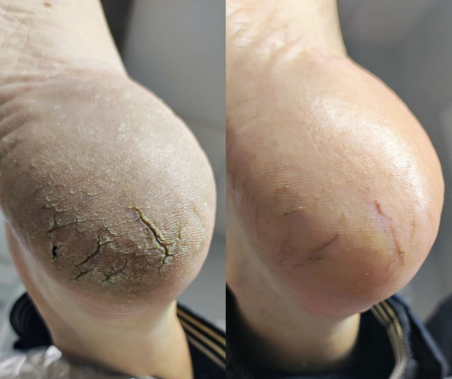 Изображение 0