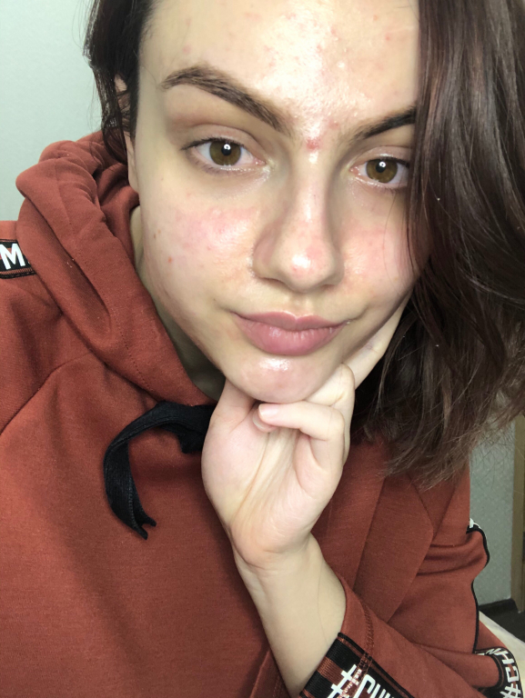 Изображение 0