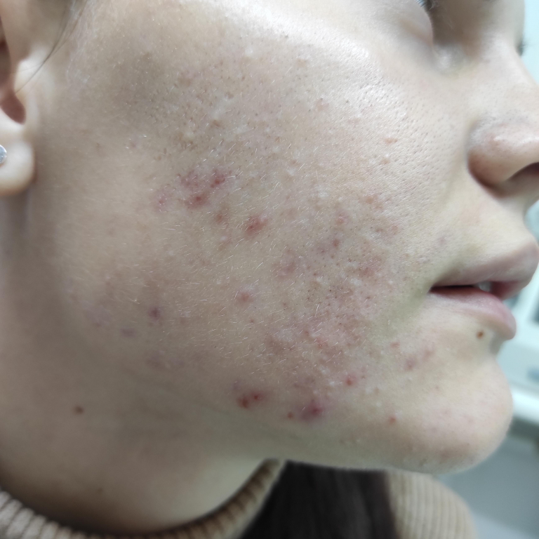 Изображение 0